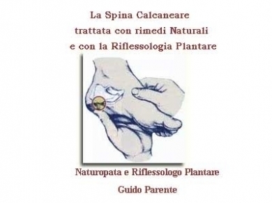 La Spina Calcaneare  trattata con Rimedi Naturali e con la Riflessologia Plantar - StudioNaturopatiaGuidoParente