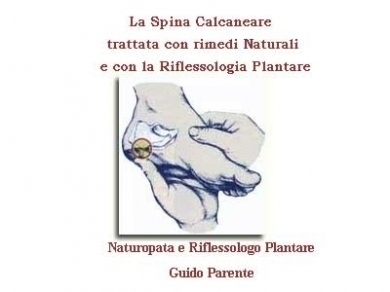 La Spina Calcaneare  trattata con Rimedi Naturali e con la Riflessologia Plantar - StudioNaturopatia GuidoParente