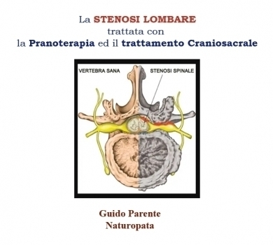 La STENOSI LOMBARE  trattata con  la Pranoterapia ed il trattamento Craniosacral - StudioNaturopatia GuidoParente