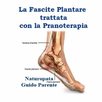 La Fascite Plantare trattata con la Pranoterapia - StudioNaturopatiaGuidoParente